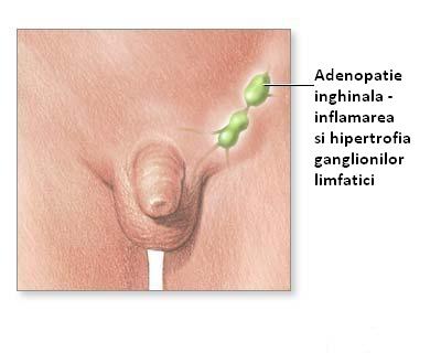 Cancerul de col uterin. Simptome și Tratament - Donna Medical Center