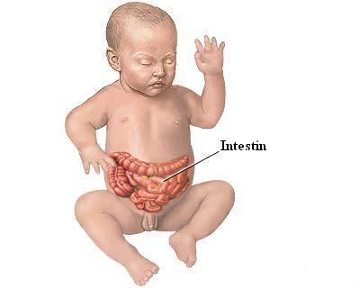 Intestinul iritabil la copil