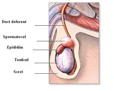 Spermatocelul (chistul epididimal)