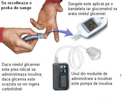 Cetoacidoza diabetica