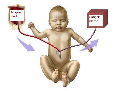 Icterul la nou nascuti (hiperbilirubinemia)