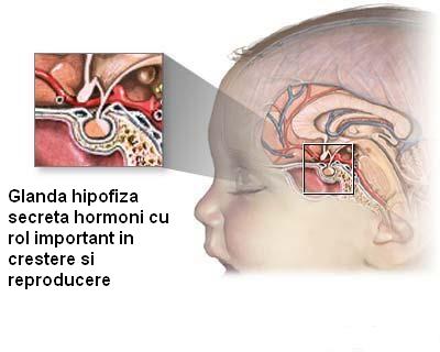 Tumorile hipofizare (ale glandei pituitare)