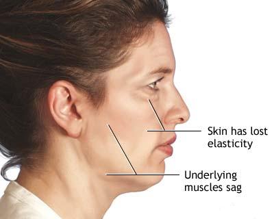 Proceduri cosmetice: liftingul facial