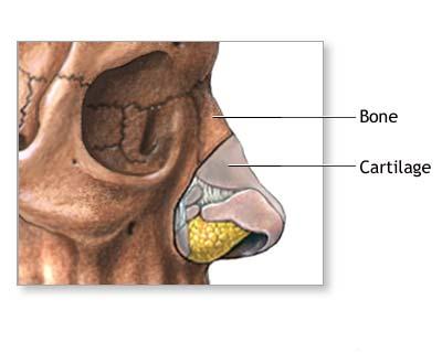 Corectia nasului (rinoplastia)