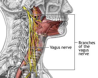 Tratament: stimularea nervului vag