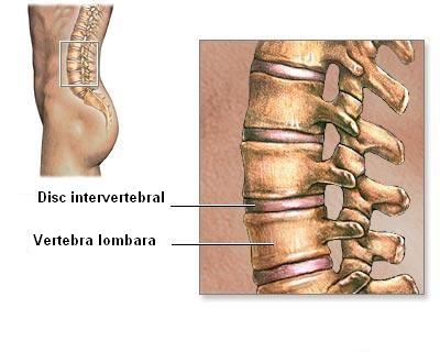 osteoartrita lombară unde sunt tratate articulațiile din Ulyanovsk