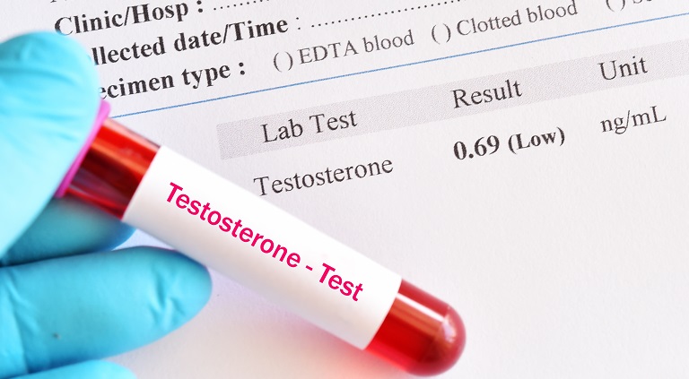 Scaderea testosteronului la femei - cauze si efecte