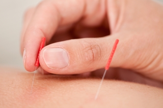cum se trateaza prostatita cu acupunctura
