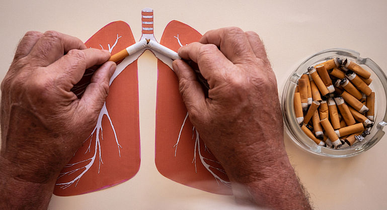 Rolul fumatulul si a expunerilor profesionale in aparitia cancerului pulmonar