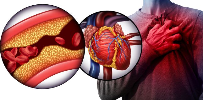 Exista vreo legatura intre masa musculara si riscul de boli cardiovasculare