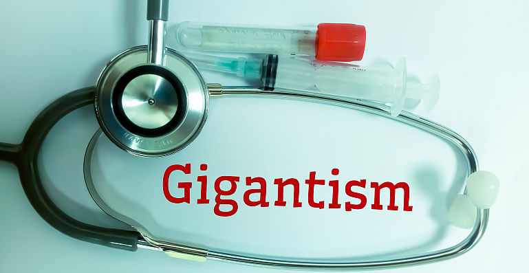 Gigantism si acromegalie