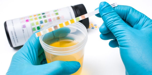Infecţiile tractului urinar-Cauze, prezentare clinică, diagnostic, complicaţii şi tratament
