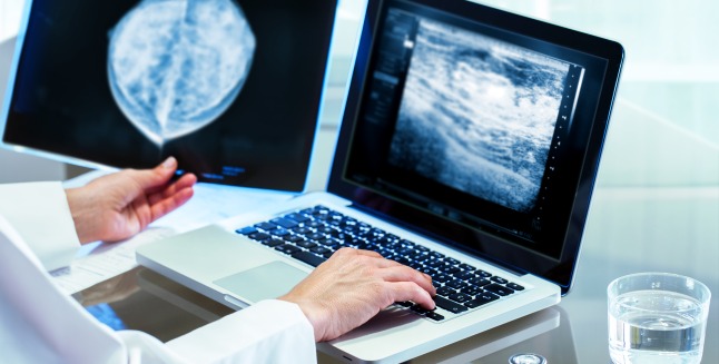 Ce alternative ale mamografiei sunt disponibile si cum functioneaza?