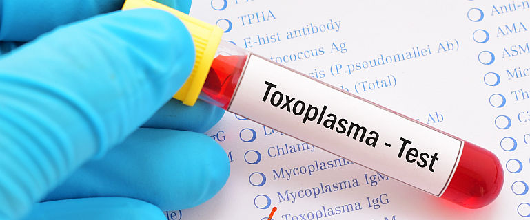 Totul despre toxoplasmoza - cauze, simptome, tratament