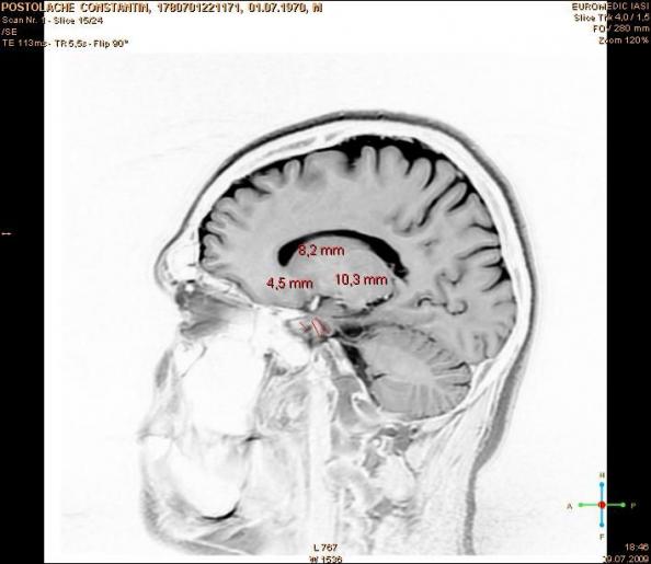 3_Imagine RMN _09.07.2009