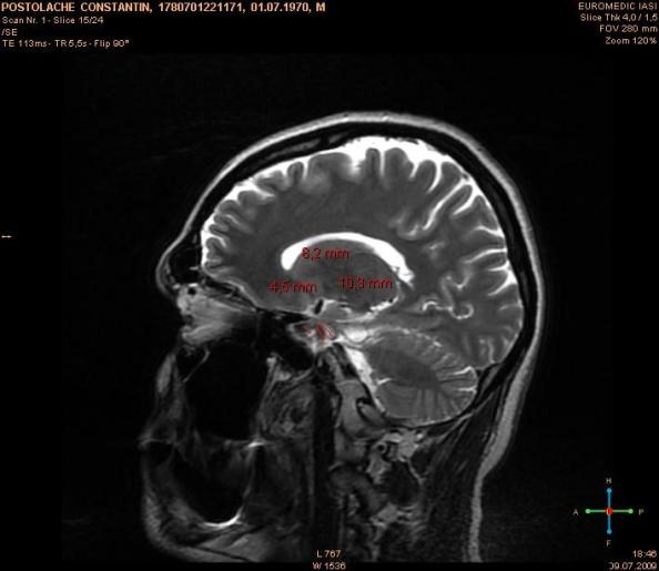 4_Imagine RMN _09.07.2009