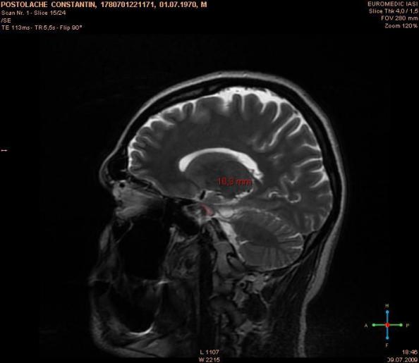 5_Imagine RMN _09.07.2009