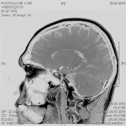 6_Imagine RMN _20.04.2010