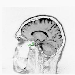 1_Imagine RMN _09.07.2009