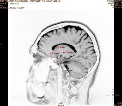 3_Imagine RMN _09.07.2009