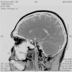 6_Imagine RMN _20.04.2010