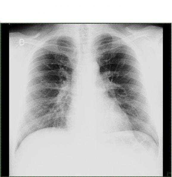 Radiografie