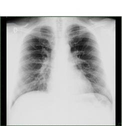 Radiografie