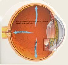 RETINOFOTOGRAF 3D OCT ( FUNDUS CAMERA)