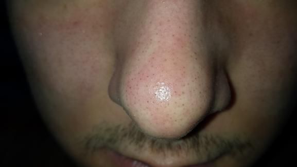 Ajutor! Pete pe fata de la apa