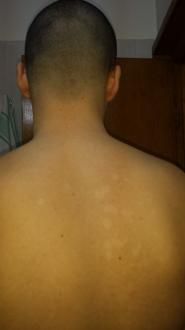 Pete pe corp (spate)