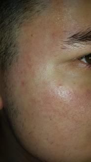 Ajutor! Pete pe fata de la apa 2