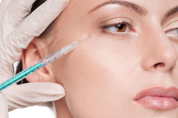 Injectare toxina botulinica