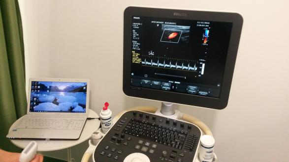 Ecograf Doppler Clear Vue 550 iScan type