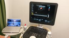 Ecograf Doppler Clear Vue 550 iScan type