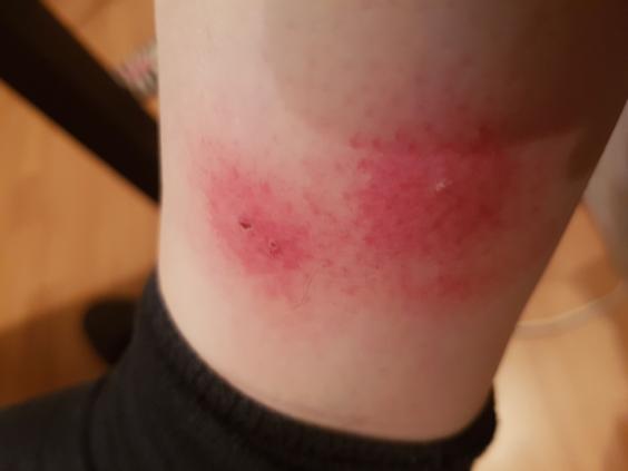 Prima instanta iritatie